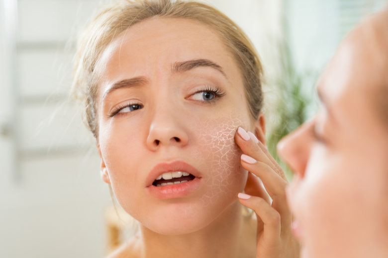 Сухая кожа — как укрепить ее гидролипидный барьер? Kedma Cosmetics